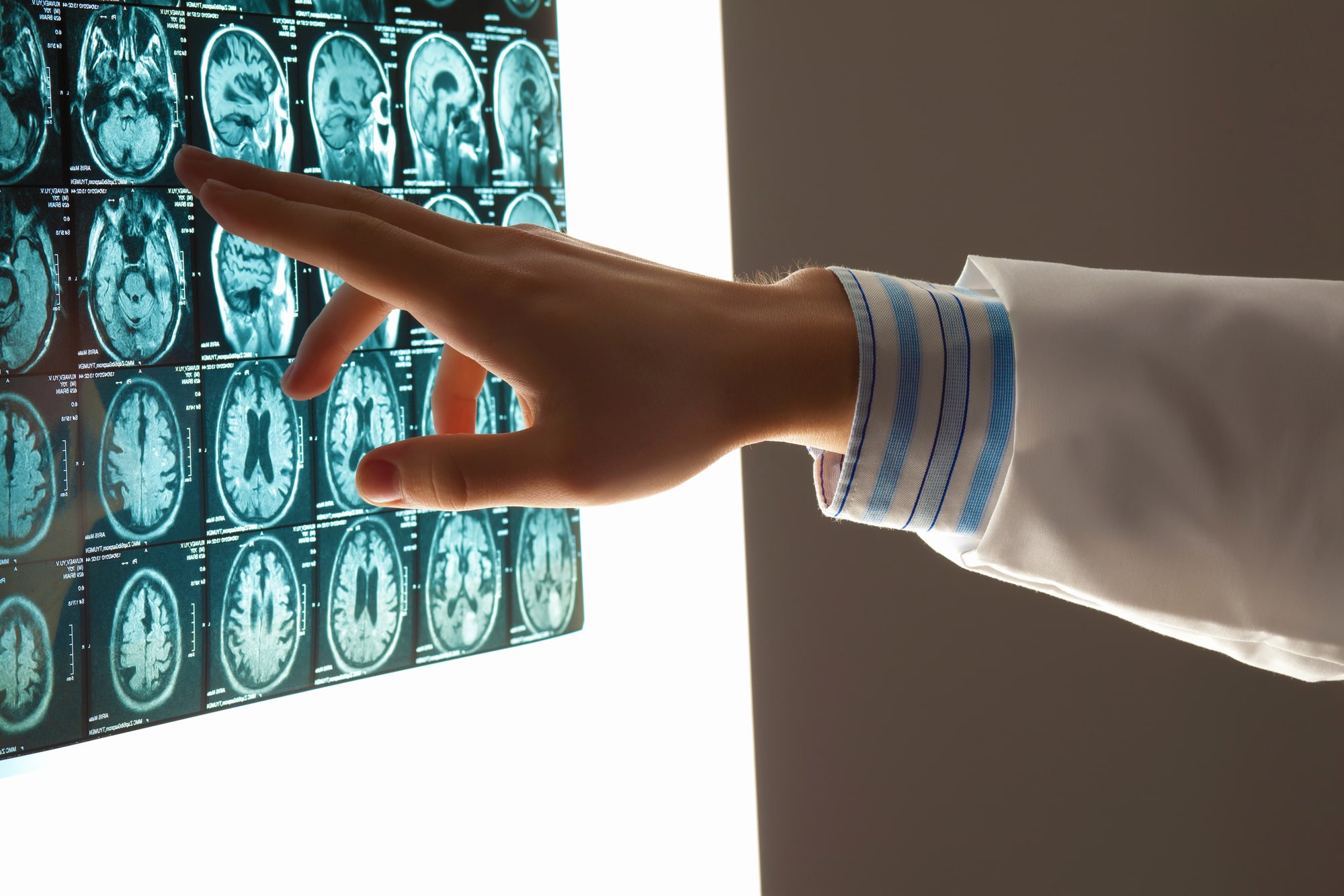 brain injury lawyer in Broward County, Florida